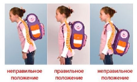 gotovimsya k shkole–rekomendatsii detskogo ortopeda 4